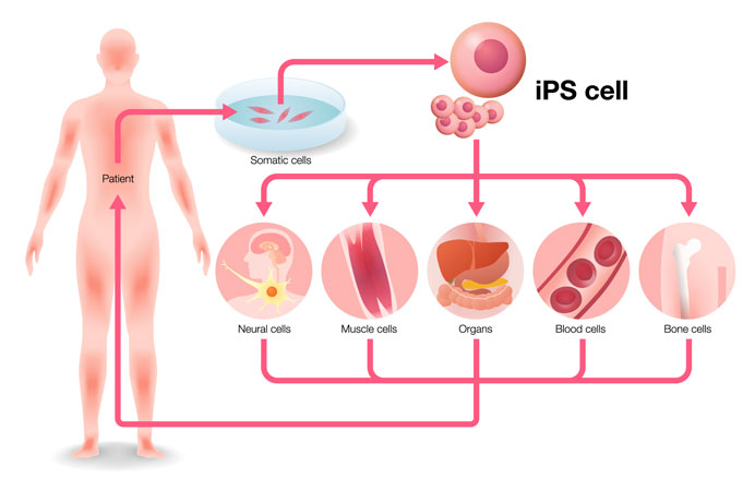 iPS細胞